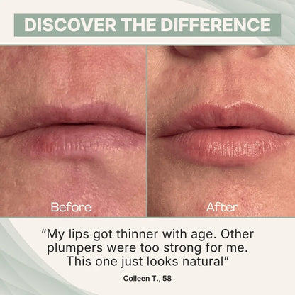 Areliaa Lip Plumper